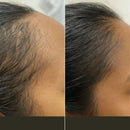 Escova de Terapia Capilar: TheraBrush Smarts 4 em 1