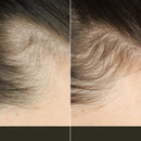 Escova de Terapia Capilar: TheraBrush Smarts 4 em 1